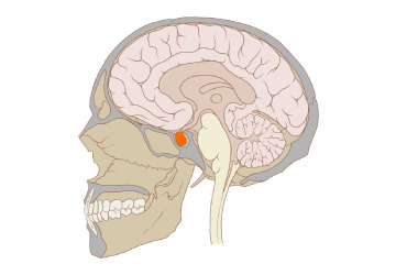 pituitary-diseases