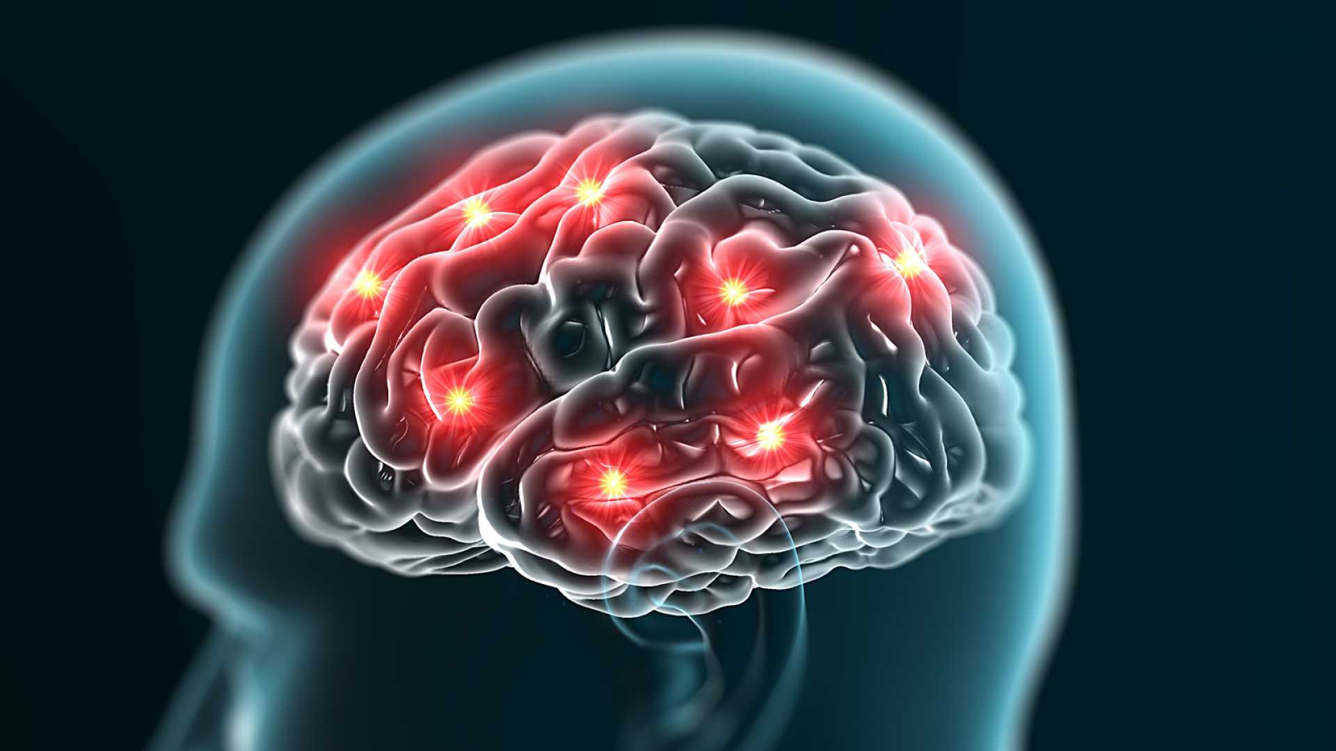You are currently viewing Tips to increase memory and the neurological factor behind that.