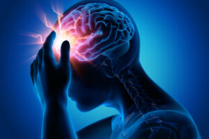 Read more about the article All About Migraine, Symptoms, Treatment